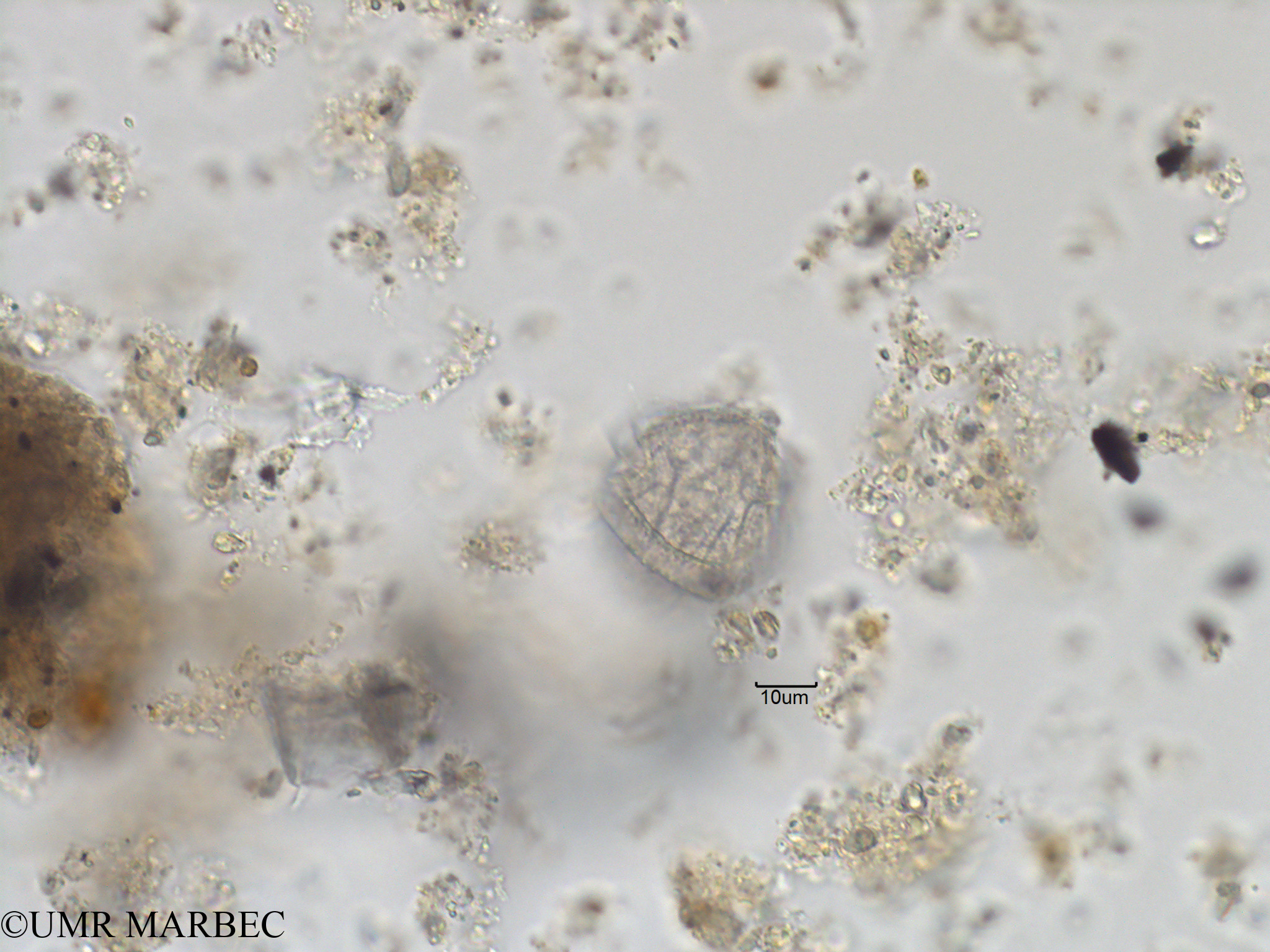 phyto/Bizerte/bizerte_bay/RISCO November 2015/Gonyaulax spinifera (Baie_T1C-Gonyaulax cf polygramma-5).tif(copy).jpg
